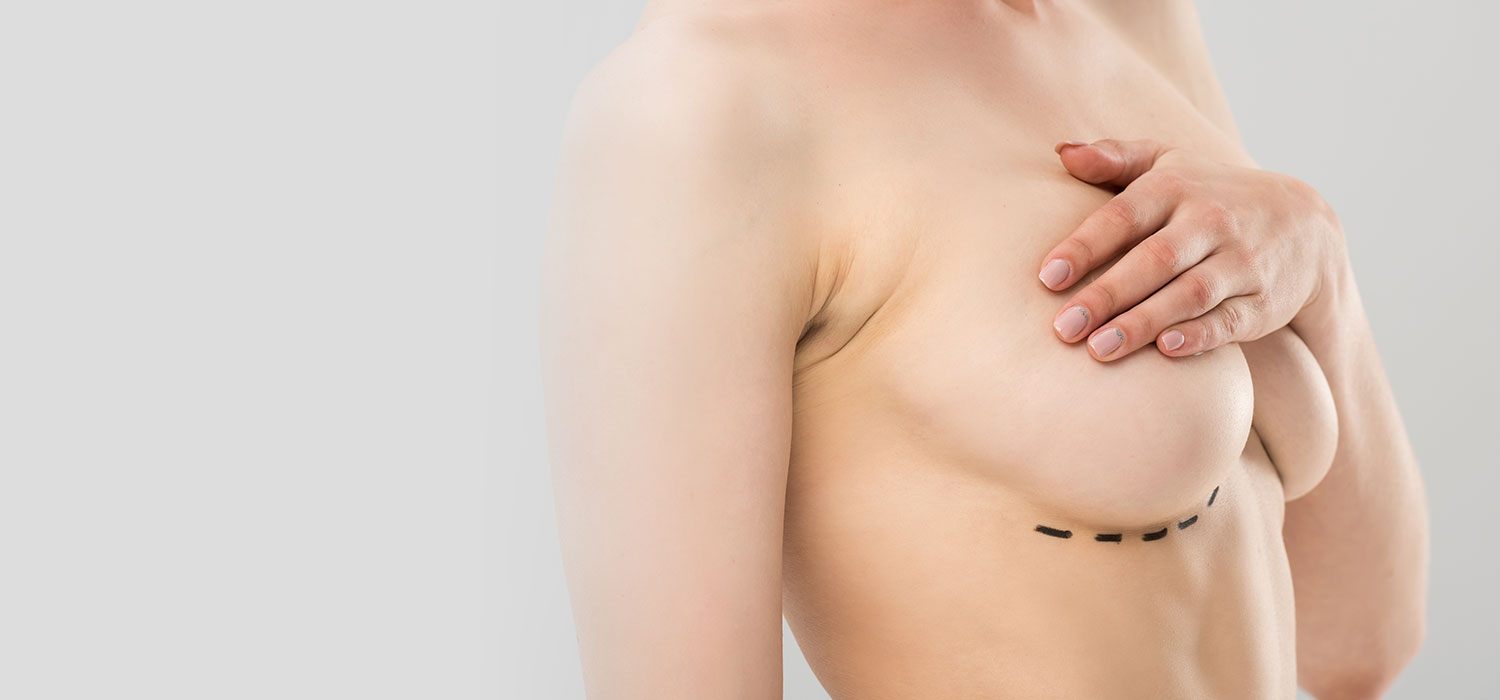 dr burhan demir Breast Augmentation 1